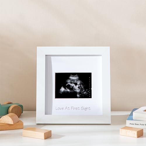 eletecpro Ultrasound Frame with 3 Mats and Real Glass Cover