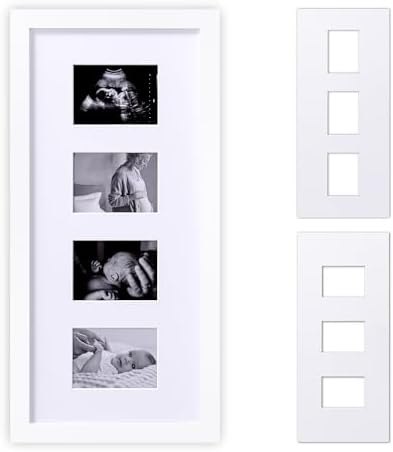 eletecpro Ultrasound Picture Frame Display 3 or 4 Photos