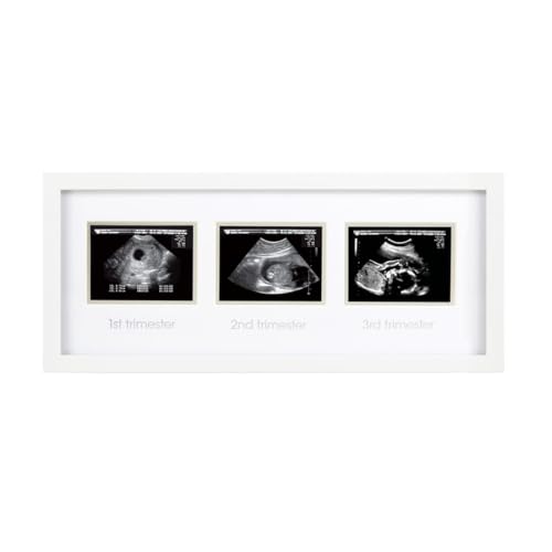 Pearhead Trimester Sonogram Frame - White