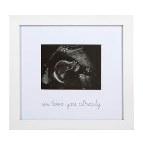 Kate Milo We Love You Already Ultrasound Frame 1