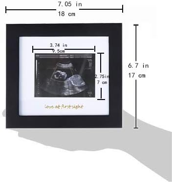 IHEIPYE Baby Sonogram Photo Frame - 1st Ultrasound Picture Frame