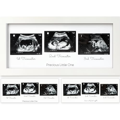 KeaBabies Trio Sonogram Photo Frames - Alpine White