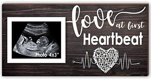 Yudarte Pregnancy Ultrasound Frame - 4x3 Inches Baby Keepsake Decor