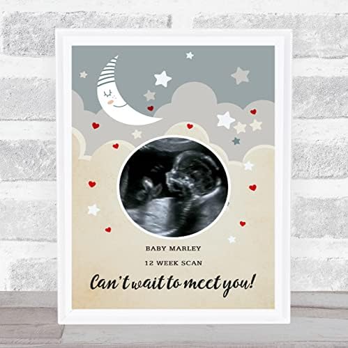 Heart Moon Pregnancy Baby Scan Picture Print Gift