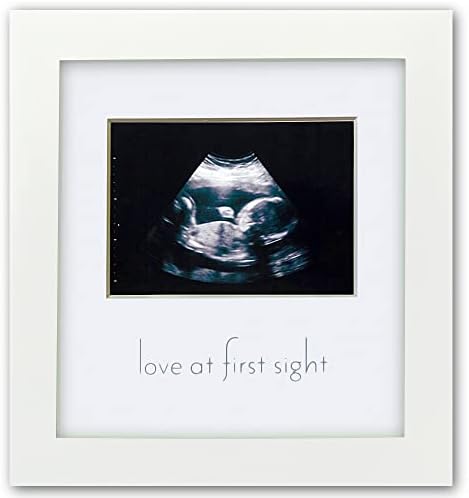 Green Pollywog Sonogram Frame - Pregnancy Gift