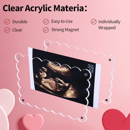 Magnetic Clear Acrylic Scalloped Ultrasound Frame - Pregnancy Announcement Display