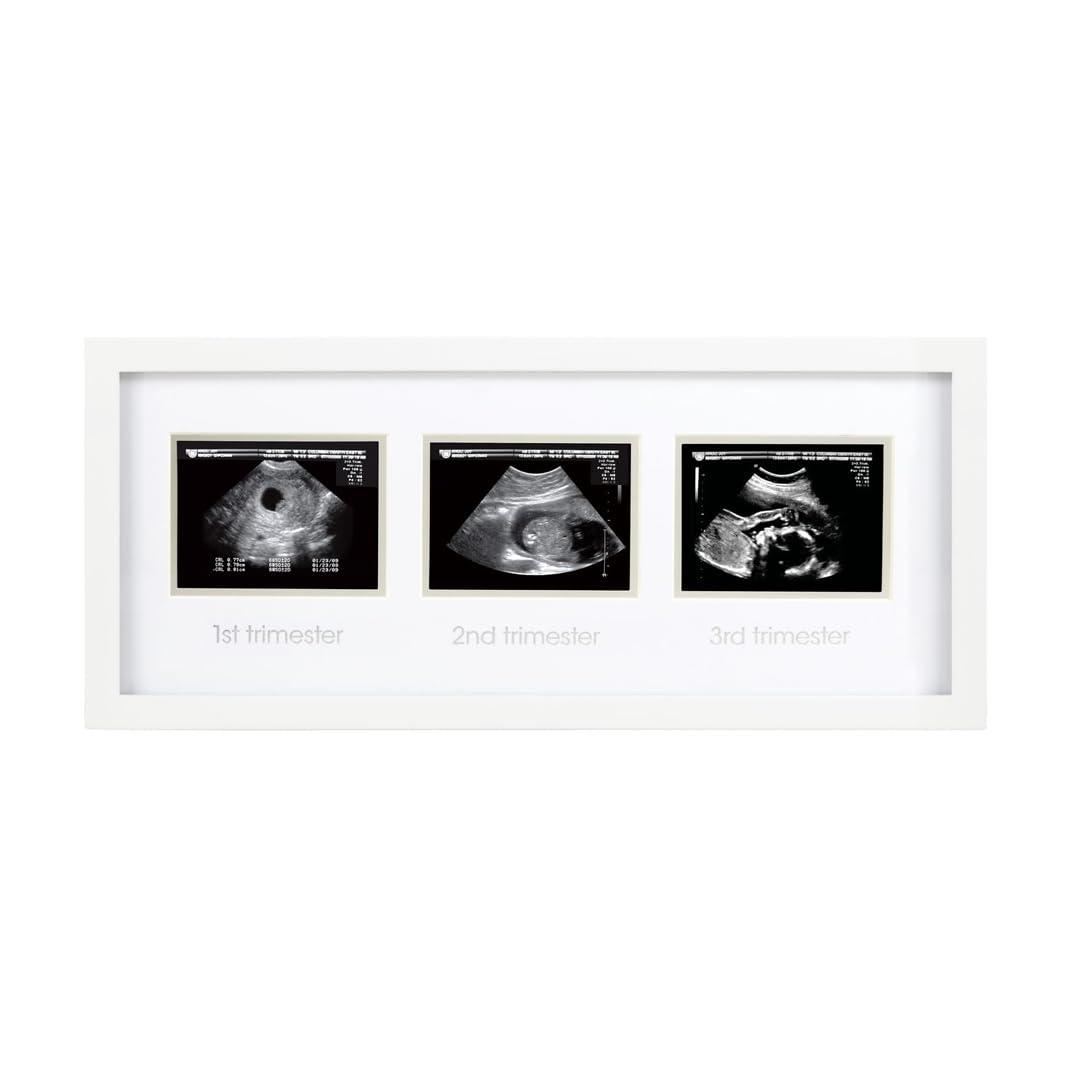 Pearhead Trimester Sonogram Frame - White
