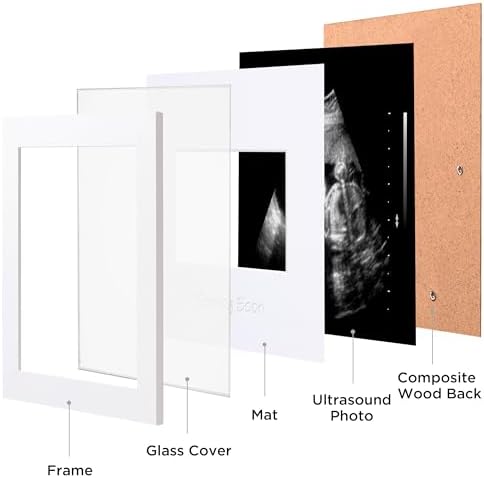 eletecpro Ultrasound Frame with 3 Mats and Real Glass Cover
