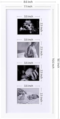 eletecpro Ultrasound Picture Frame Display 3 or 4 Photos