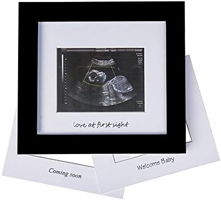 IHEIPYE Baby Sonogram Photo Frame - 1st Ultrasound Picture Frame