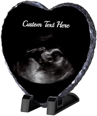 WACAR Sonogram Picture Frame - Personalized Pregnancy Keepsake Decor