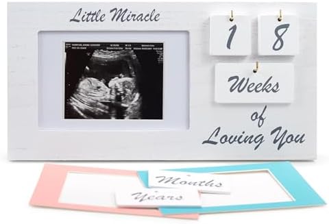 YelloIris White Ultrasound Sonogram Frame with Countdown Tiles