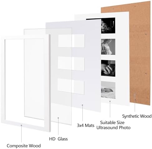 eletecpro Ultrasound Picture Frame Display 3 or 4 Photos