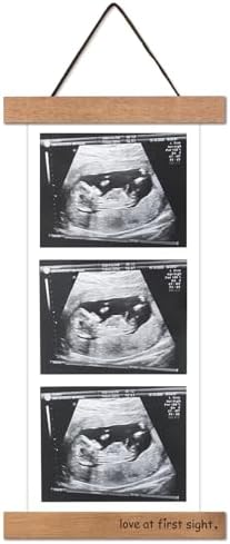 Zyeco Magnetic Ultrasound Photo Frame Wooden Keepsake Display