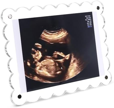 Magnetic Clear Acrylic Scalloped Ultrasound Frame - Pregnancy Announcement Display