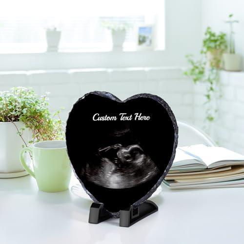 WACAR Sonogram Picture Frame - Personalized Pregnancy Keepsake Decor