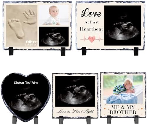 WACAR Sonogram Picture Frame - Personalized Pregnancy Keepsake Decor