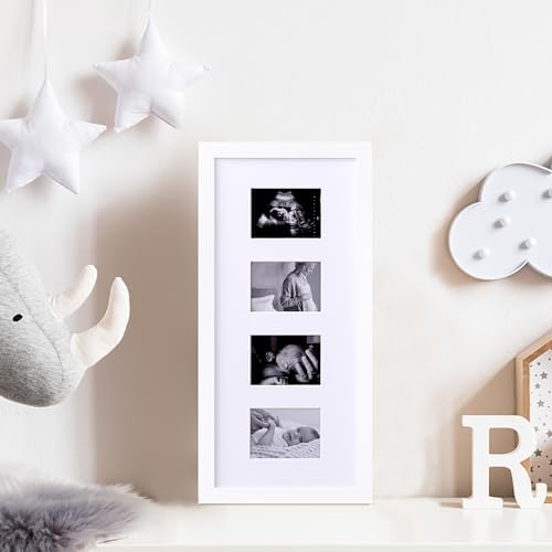 eletecpro Ultrasound Picture Frame Display 3 or 4 Photos