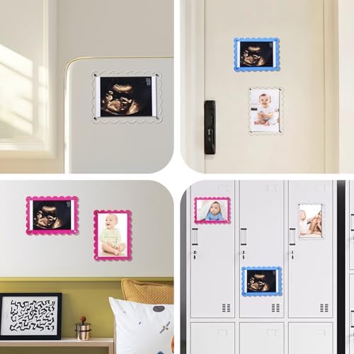 Magnetic Clear Acrylic Scalloped Ultrasound Frame - Pregnancy Announcement Display