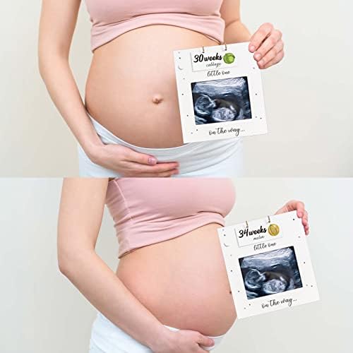 BUULUE Ultrasound Picture Frame Pregnancy Tracker