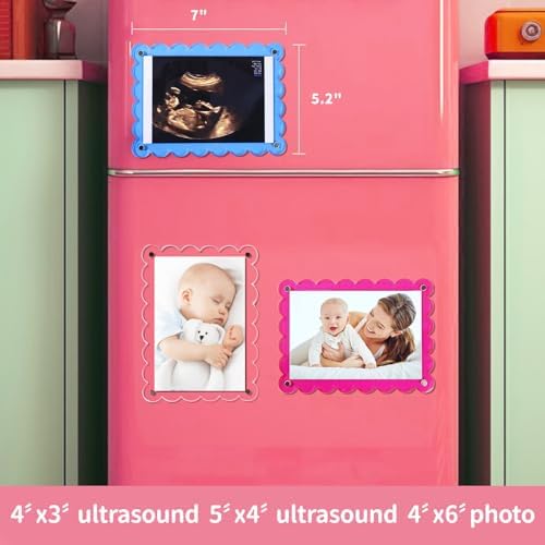 Magnetic Clear Acrylic Scalloped Ultrasound Frame - Pregnancy Announcement Display