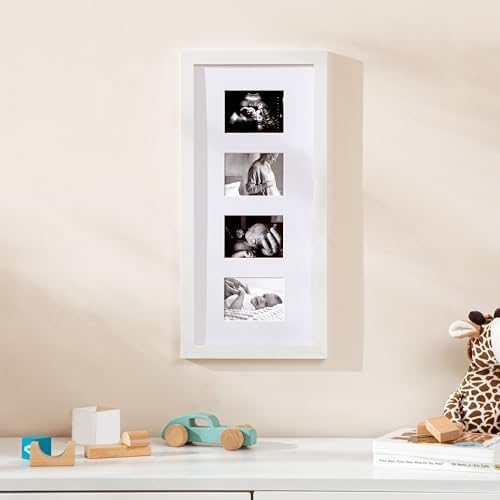 eletecpro Ultrasound Picture Frame Display 3 or 4 Photos