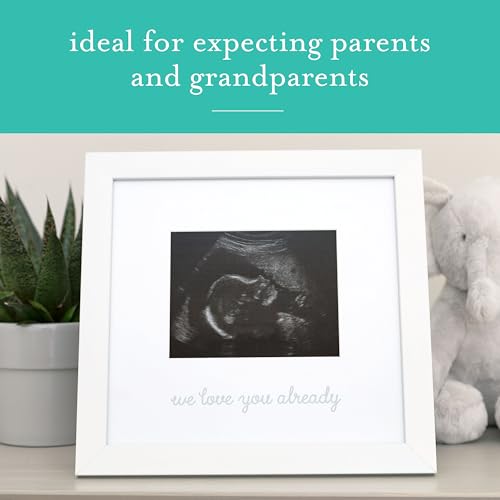 Kate Milo We Love You Already Ultrasound Frame 1