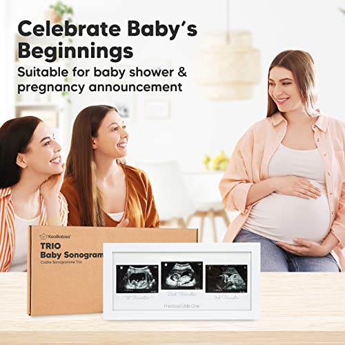 KeaBabies Trio Sonogram Photo Frames - Alpine White