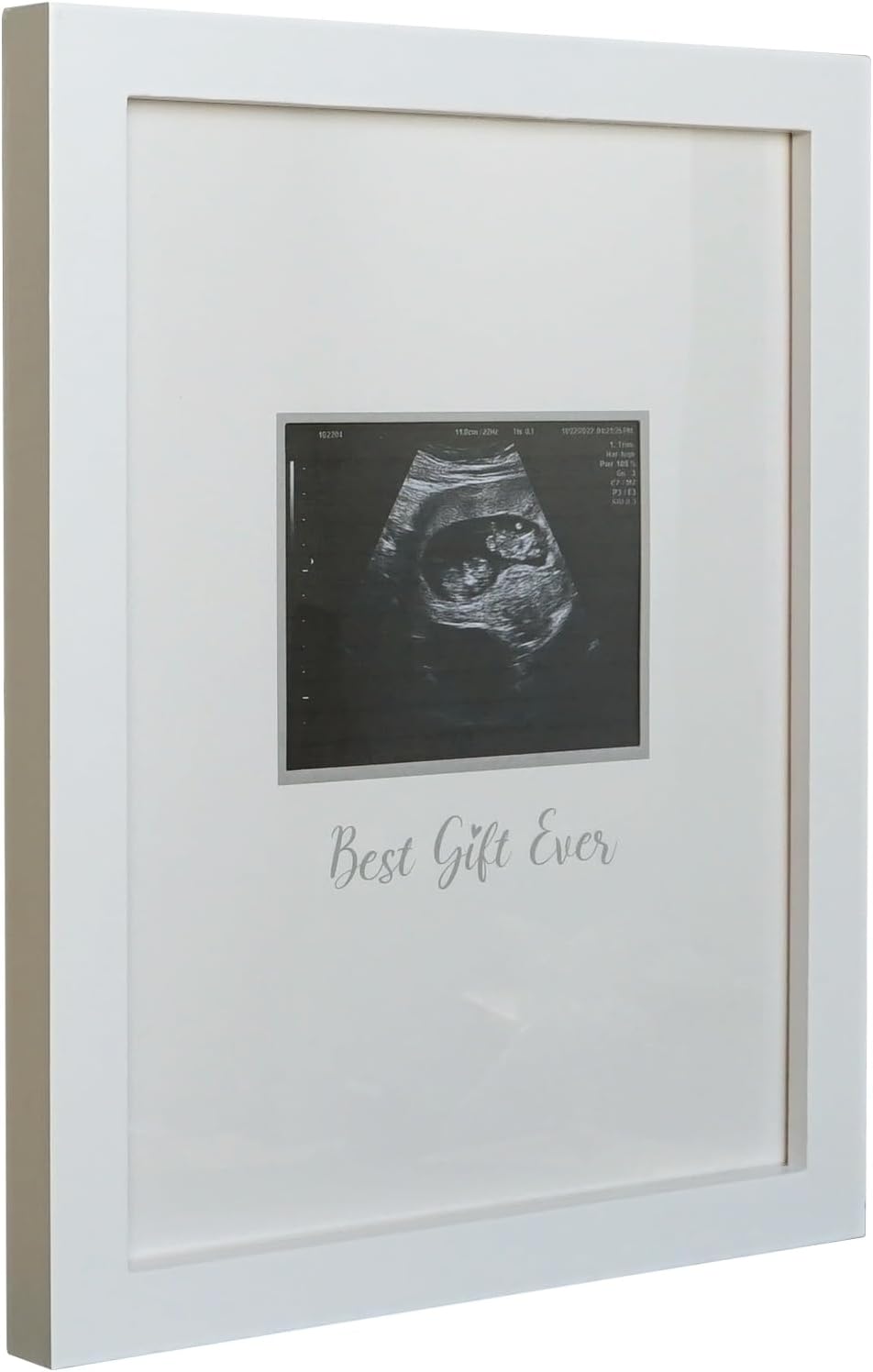Sonogram Signature Frame Guest Book for Expecting Moms
