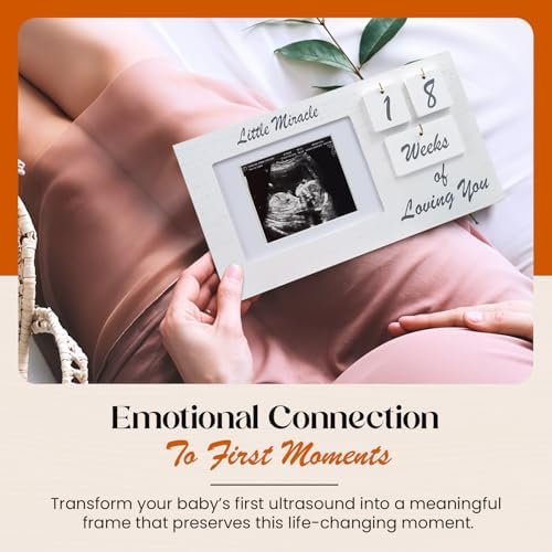 YelloIris White Ultrasound Sonogram Frame with Countdown Tiles