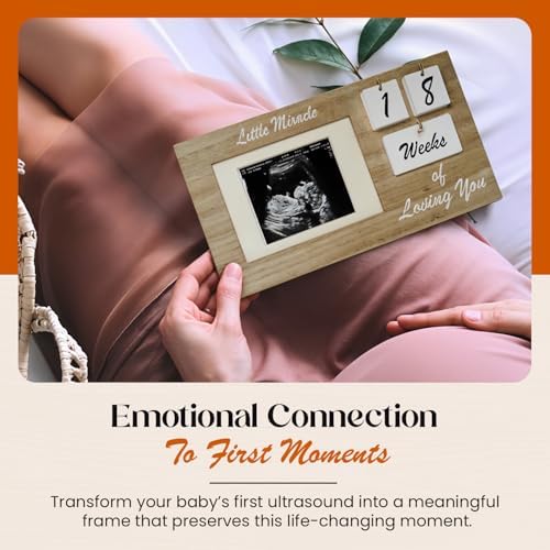YelloIris Brown Ultrasound Keepsake Frame