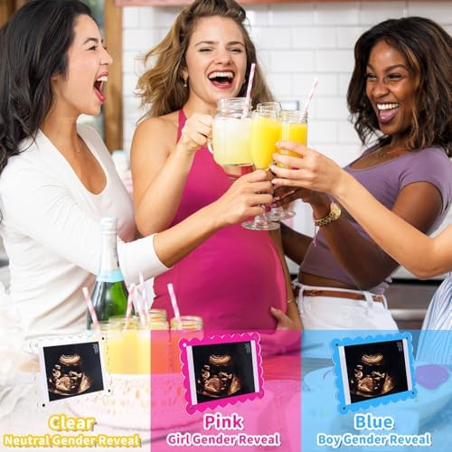 Magnetic Clear Acrylic Scalloped Ultrasound Frame - Pregnancy Announcement Display