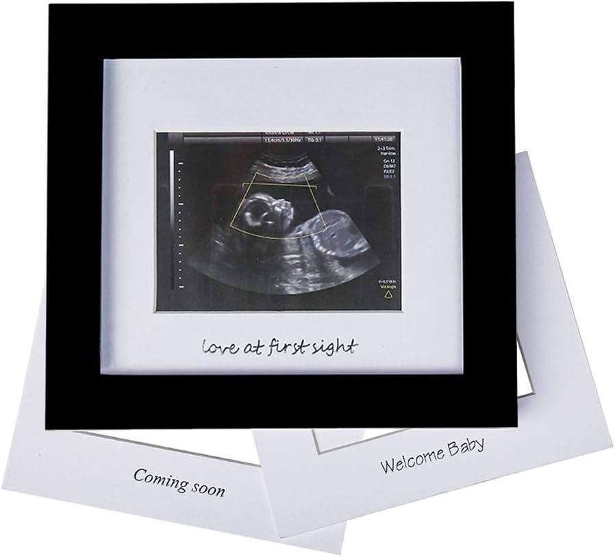 IHEIPYE Baby Sonogram Photo Frame - 1st Ultrasound Picture Frame