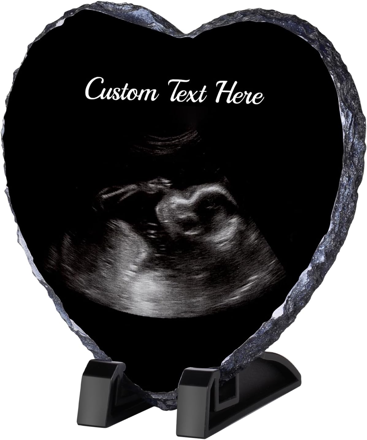 WACAR Sonogram Picture Frame - Personalized Pregnancy Keepsake Decor