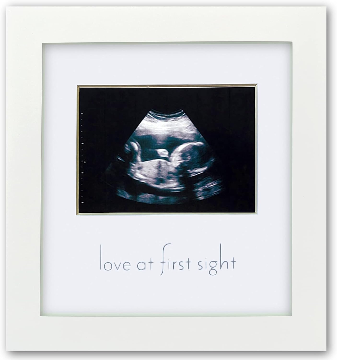 Green Pollywog Sonogram Frame - Pregnancy Gift