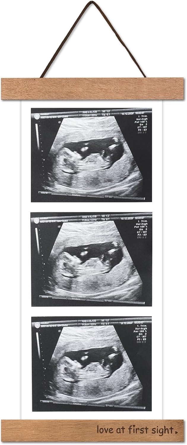 Zyeco Magnetic Ultrasound Photo Frame Wooden Keepsake Display