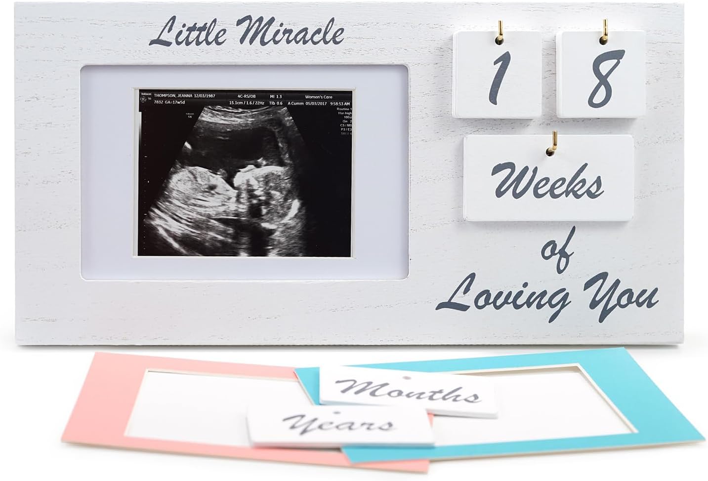YelloIris White Ultrasound Sonogram Frame with Countdown Tiles