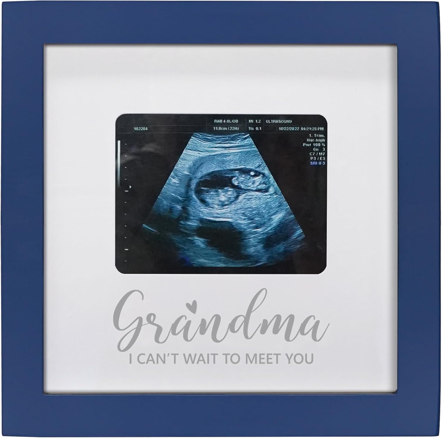 Sonogram Picture Frame for Grandma Blue