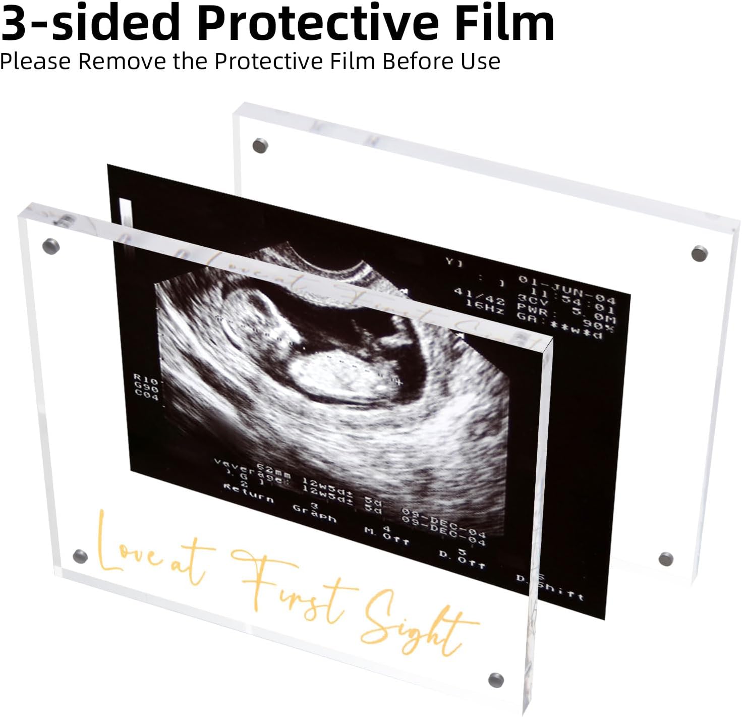 Acrylic Ultrasound Picture Frame - Unique Baby Keepsake