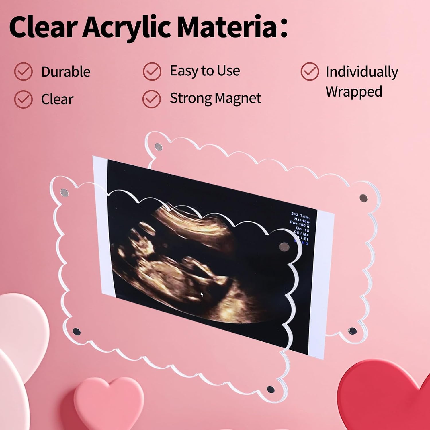 Magnetic Clear Acrylic Scalloped Ultrasound Frame - Pregnancy Announcement Display