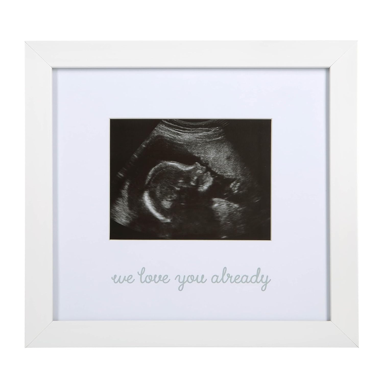 Kate Milo We Love You Already Ultrasound Frame 1