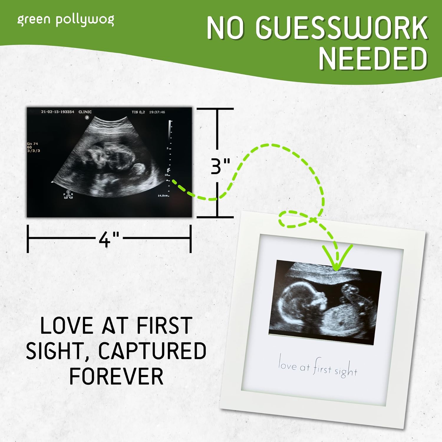 Green Pollywog Sonogram Frame - Pregnancy Gift