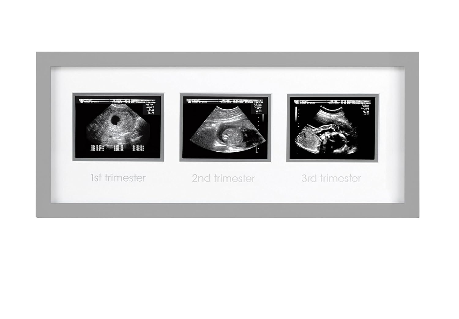 Pearhead Triple Sonogram Picture Frame Gray
