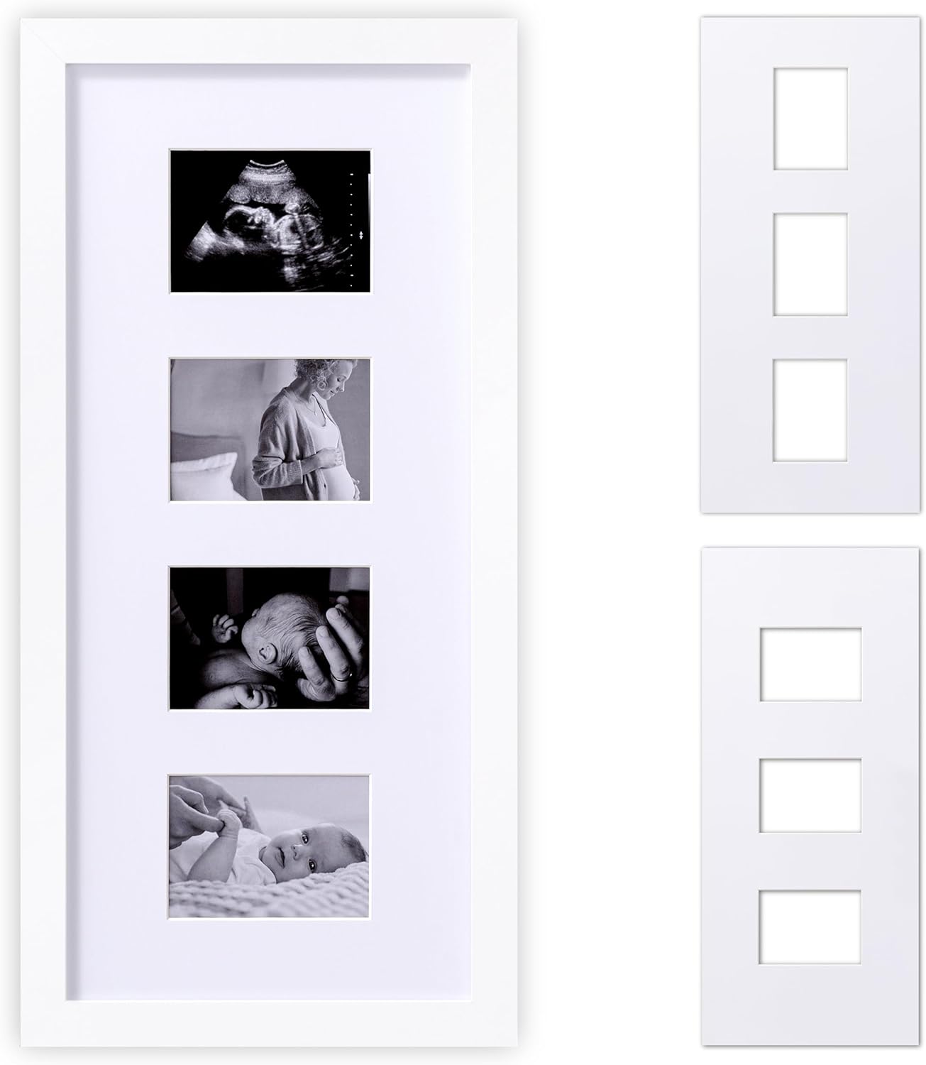 eletecpro Ultrasound Picture Frame Display 3 or 4 Photos