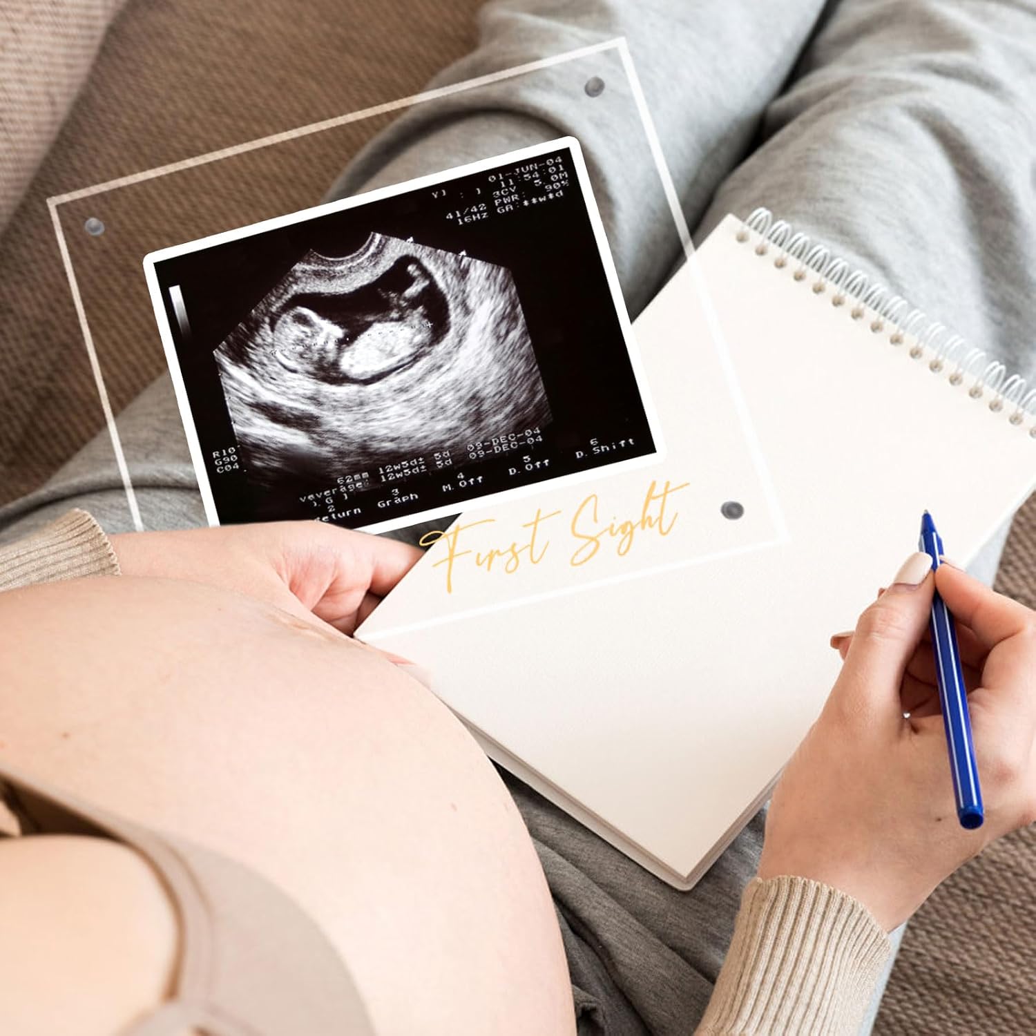 Acrylic Ultrasound Picture Frame - Unique Baby Keepsake
