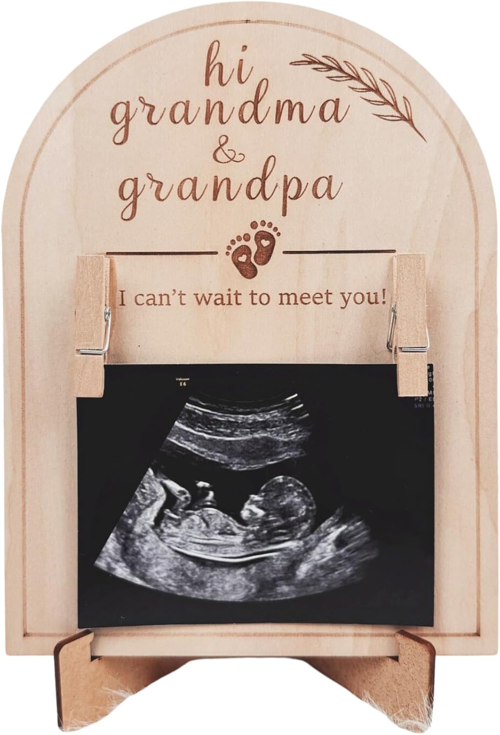 HONOCOOLS Baby Ultrasound Photo Frame - Pregnancy Reveal Keepsake for Grandparents