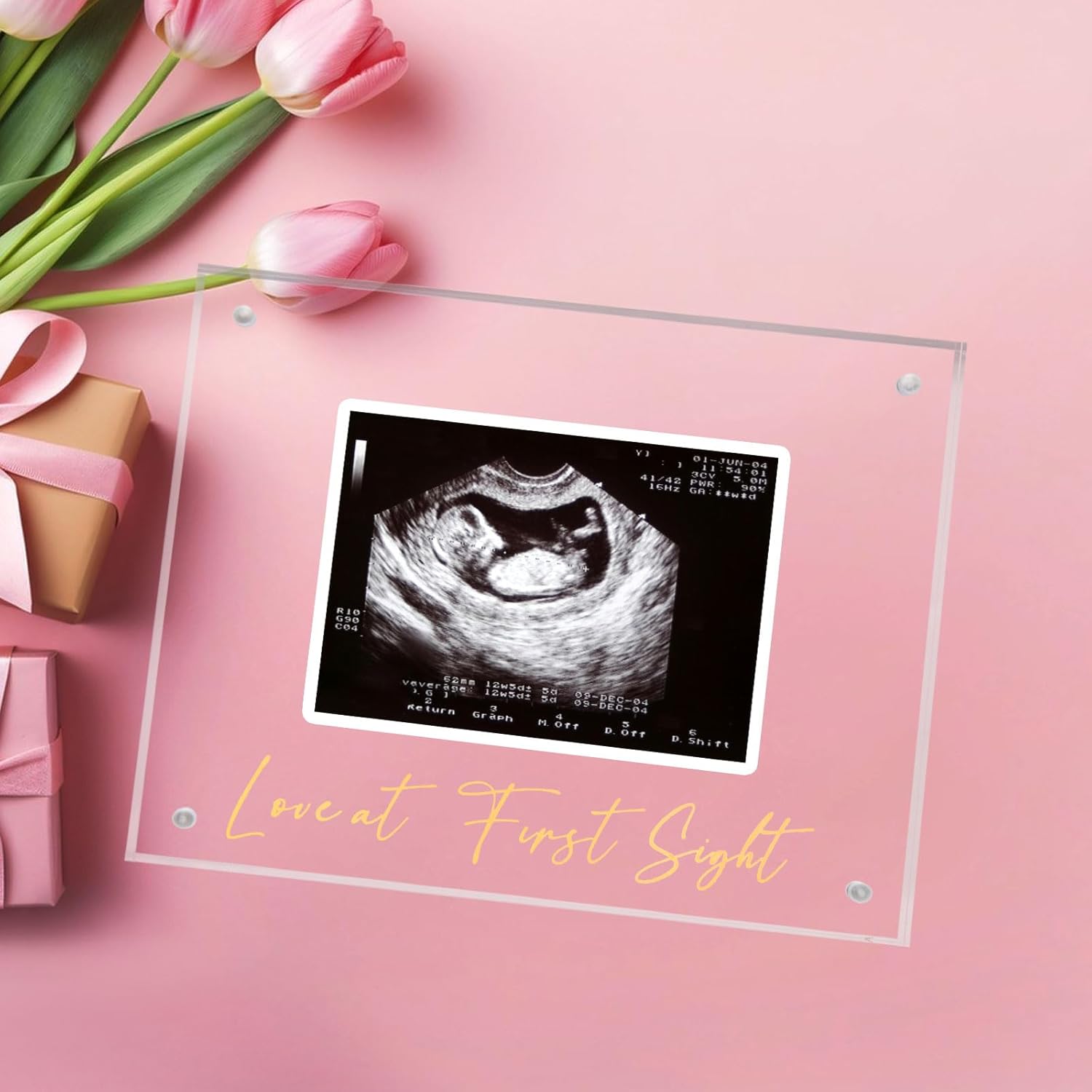 Acrylic Ultrasound Picture Frame - Unique Baby Keepsake