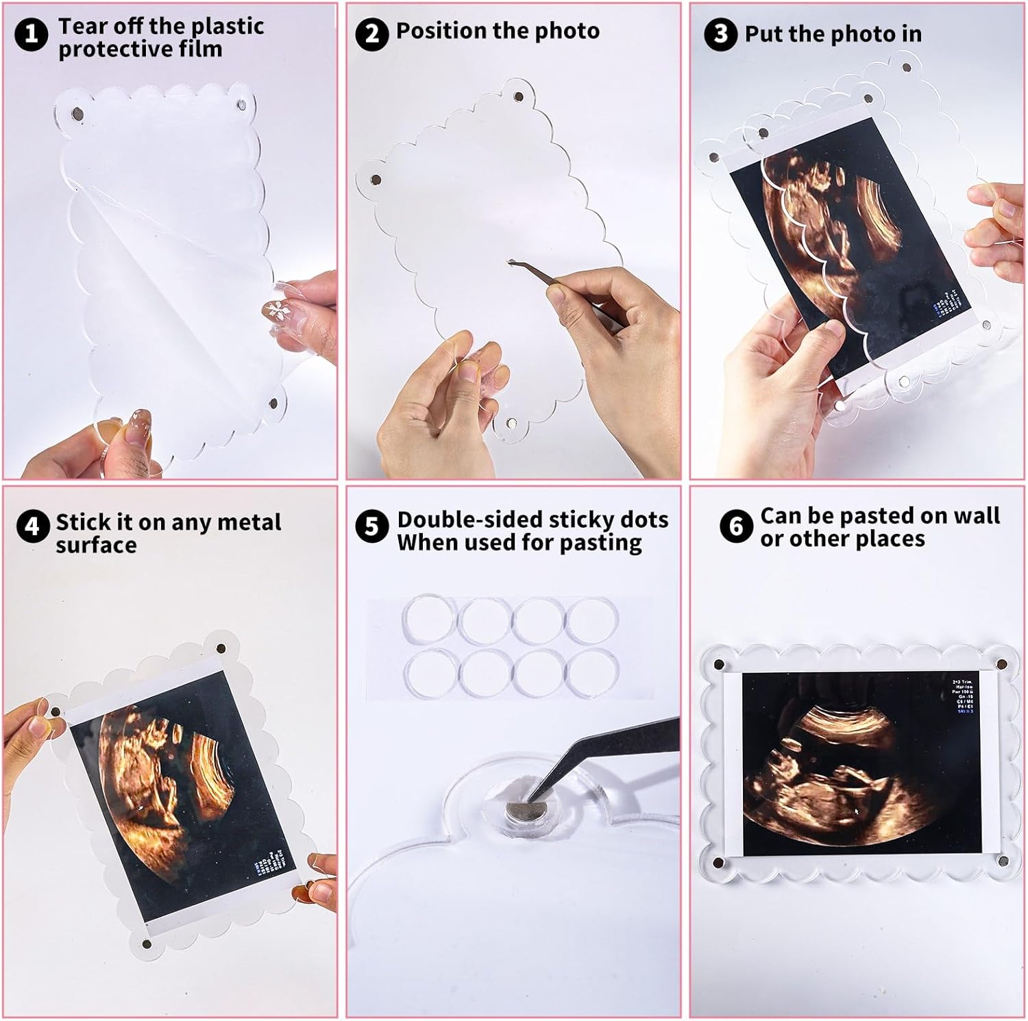 Magnetic Clear Acrylic Scalloped Ultrasound Frame - Pregnancy Announcement Display