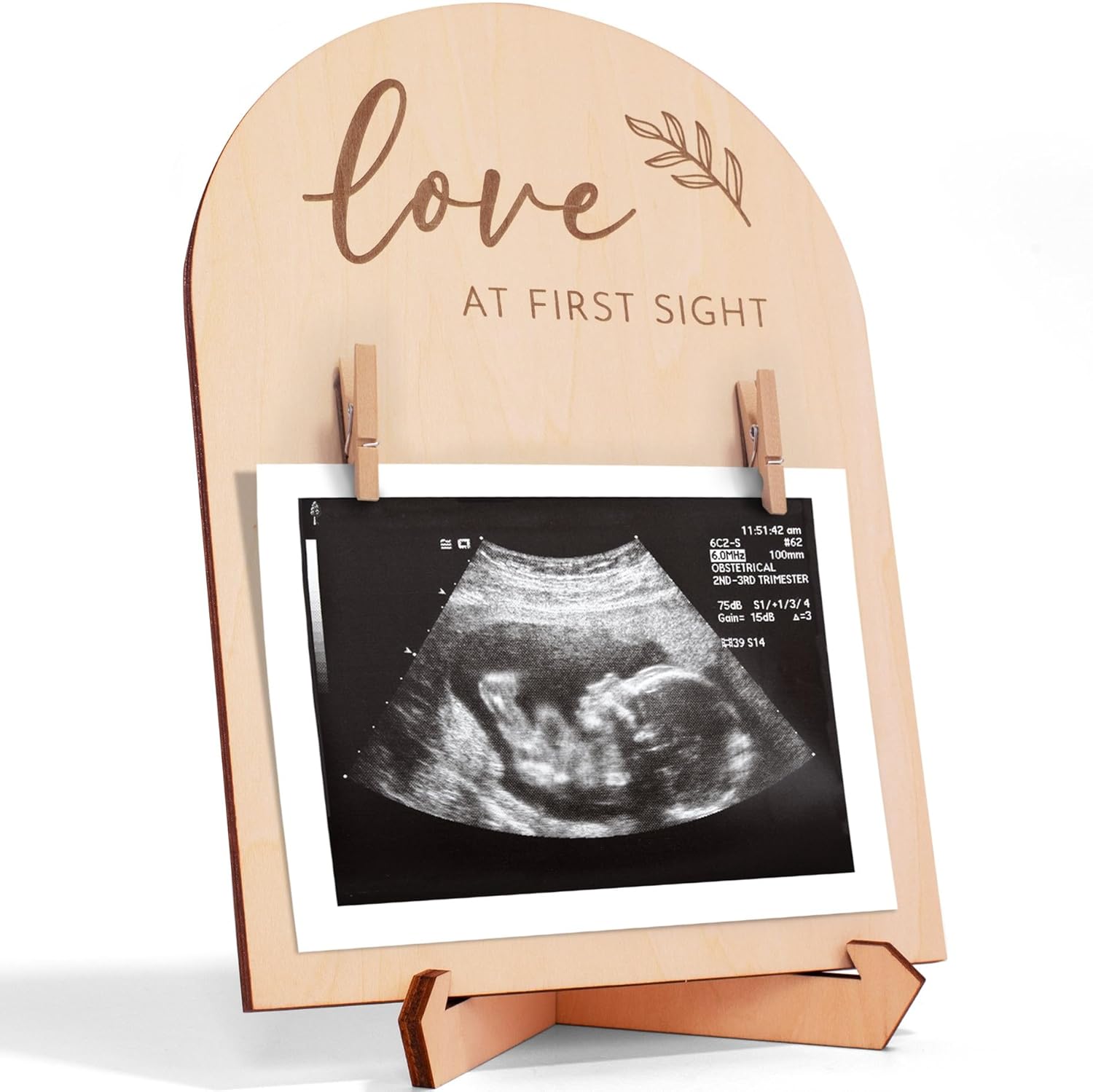 KIBAGA Cute Double Sided Ultrasound Frame