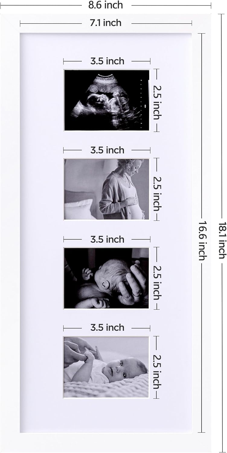 eletecpro Ultrasound Picture Frame Display 3 or 4 Photos